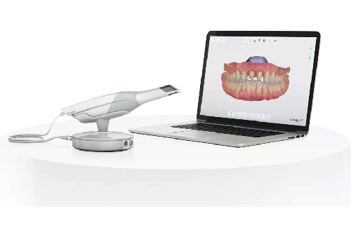 maui oral surgery intra-oral scanning